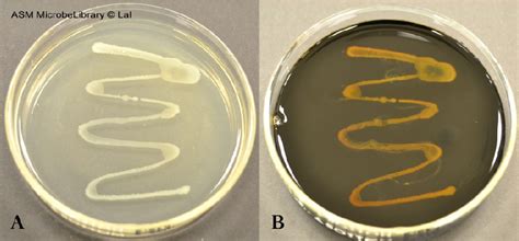 Starch Agar Protocol .